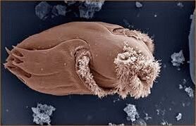 Micro-organismes pathogènes chez l'homme