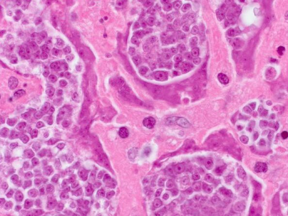 Rechercher des parasites chez une personne