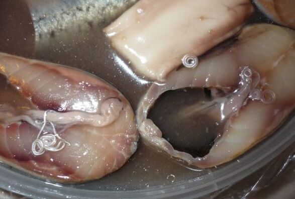 Voies d'infection humaine par les parasites