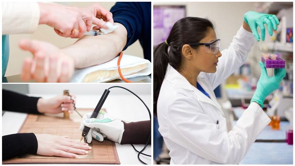 Méthodes de diagnostic pour détecter les parasites dans le corps