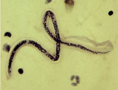 Vers du cœur de Bancroft