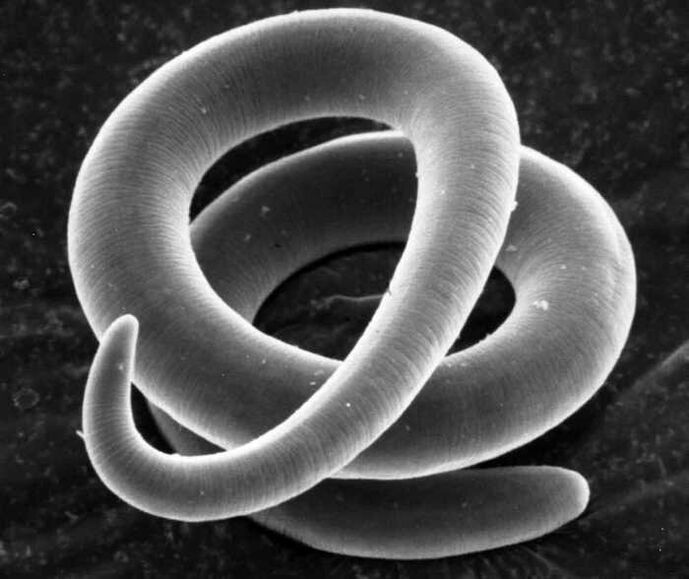Trichinella au microscope